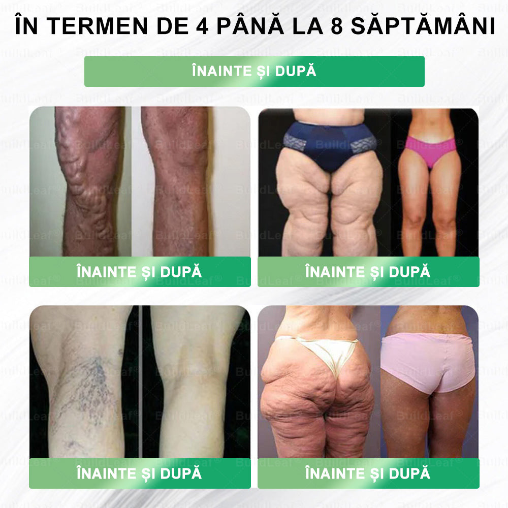 ❤️Mai rămase doar 5 cutii! Reducere de 50% suplimentară! Recâștigă-ți forma și sănătatea! Dacă ratezi această oportunitate acum, anul viitor s-ar putea să fie deja prea târziu! 💥🔥