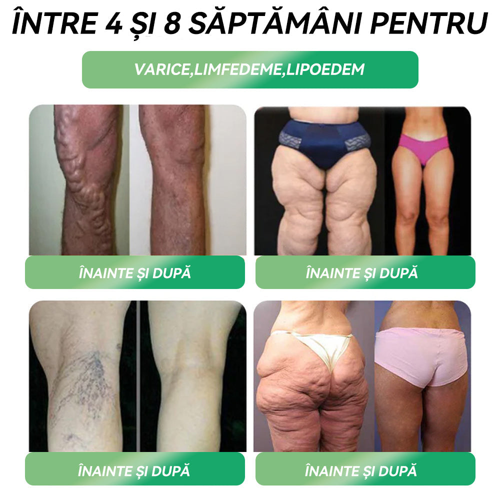 🏥Au mai rămas doar 5 cutii! Prinde acum reducerea de 50%! Recâștigă-ți silueta și sănătatea! Dacă ratezi această șansă acum, anul viitor poate fi prea târziu! 🔥